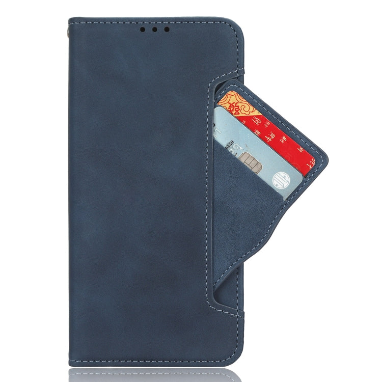 For Sony Xperia 10 VI 2024 Skin Feel Calf Texture Card Slots Leather Phone Case(Blue) - Sony Cases by buy2fix | Online Shopping UK | buy2fix